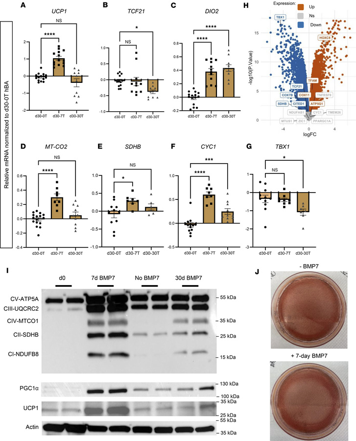 Omitting BMP7 treatment in hBAs decreased brown and thermogenic markers....
