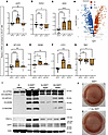 Omitting BMP7 treatment in hBAs decreased brown and thermogenic markers.