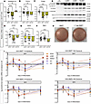 BMP7 treatment decreased TCF21 white adipocyte markers and decreased beige