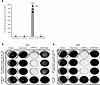 Characterization of EMT6 triple-negative breast cancer–expressing E. coli P