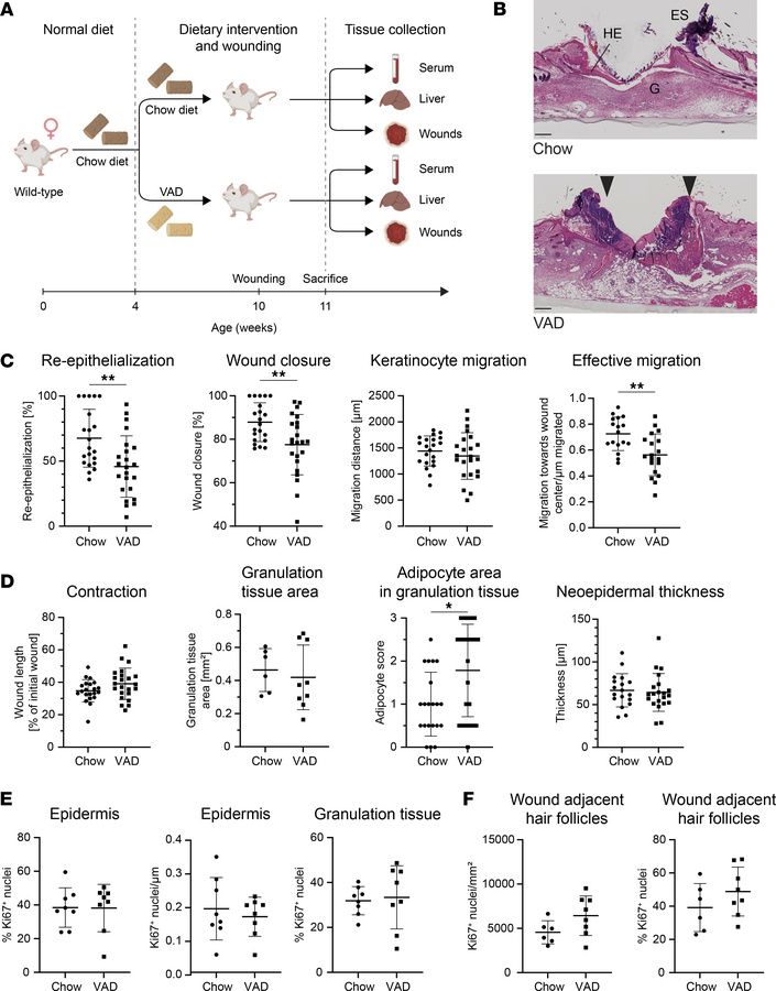 Vitamin A deficiency delays wound healing in mice.
(A) Schematic outline...