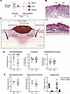 Stra6 is dispensable for wound healing in mice.