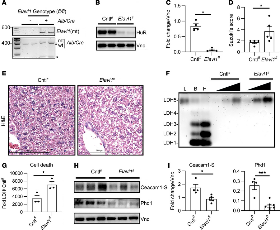 Hepatic HuR-null mutation augments cytotoxic stress, leading to loss of ...