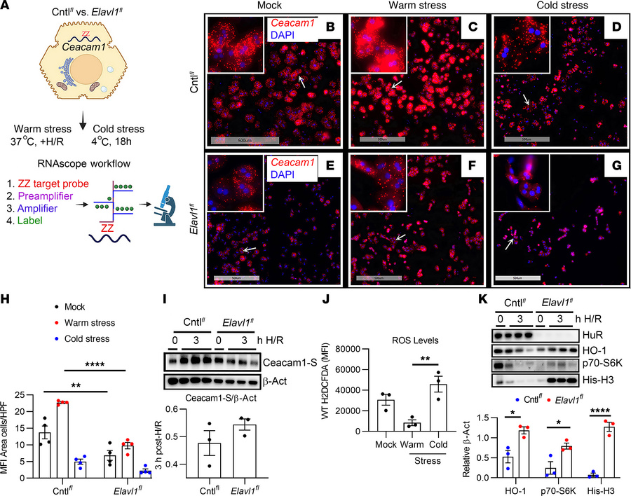 Hepatic Ceacam1 mRNA depends on HuR signaling during temperature-depende...