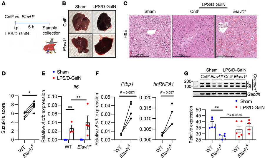 Acute liver injury compromises posttranscriptional HuR regulation of Cea...