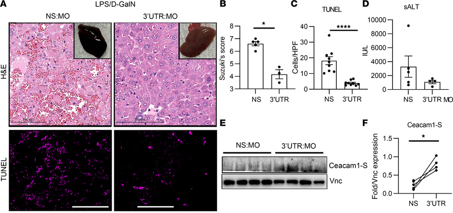 MO-mediated targeting of Ceacam1 3′UTR alleviates liver sterile inflamma...