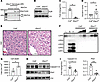 Hepatic HuR-null mutation augments cytotoxic stress, leading to loss of Cea