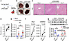 Acute liver injury compromises posttranscriptional HuR regulation of Ceacam