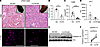 MO-mediated targeting of Ceacam1 3′UTR alleviates liver sterile inflammatio