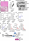 Hepatic ELAVL1 and CEACAM1 mRNA expression correlate with improved tissue h
