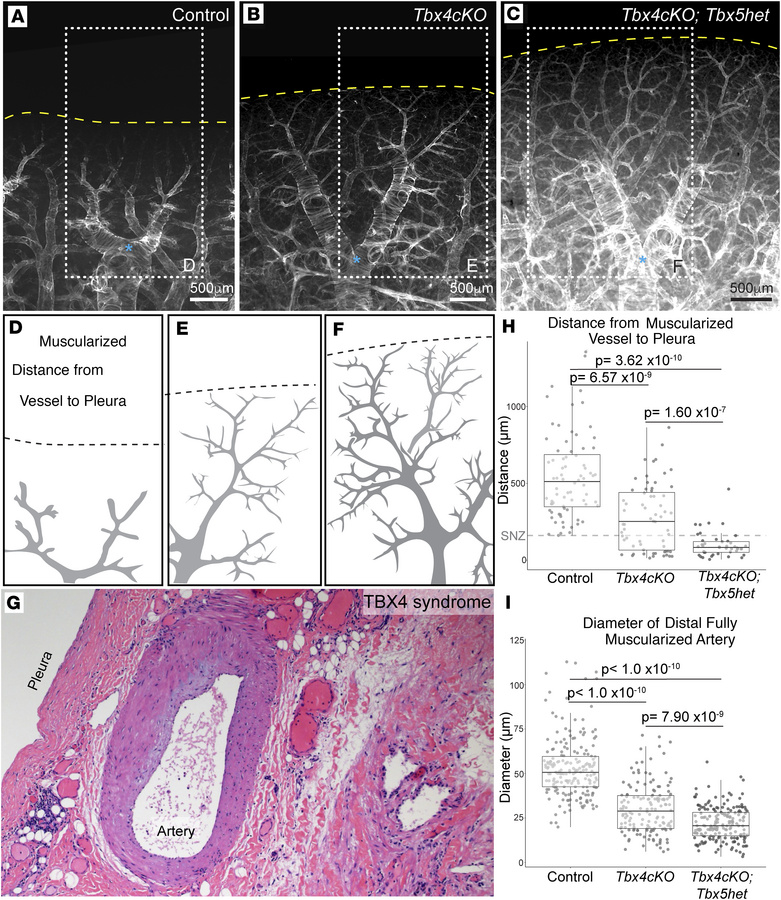 Whole-mount analysis reveals increased vascular smooth muscle coverage o...
