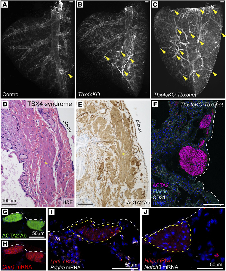 Loss of T-box genes leads to expansion of ectopic subpleural smooth musc...