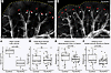 Decreased distance between muscularized airways and arteries and the pleura