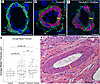 Tbx4cKO and Tbx4cKO;Tbx5het mice display pulmonary artery muscularization c