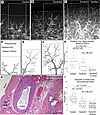 Whole-mount analysis reveals increased vascular smooth muscle coverage of p