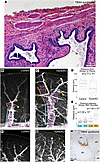 Airway smooth muscle extends closer to the pleura and is mispatterned in Tb