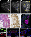 Loss of T-box genes leads to expansion of ectopic subpleural smooth muscle