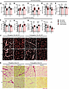 Muscle collagen remodeling.
