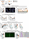 Adoptive transfer of hypoxia-treated macrophages.