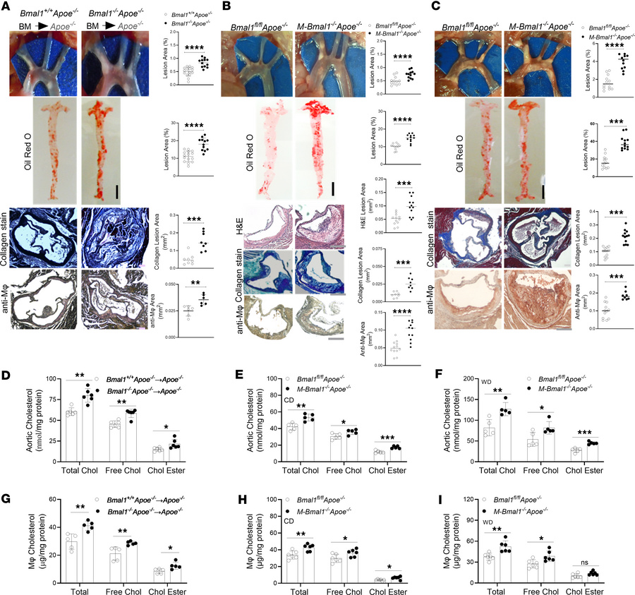 Mφ-specific Bmal1 deficiency increases atherosclerosis in various mouse ...