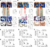 Mφ-specific Bmal1 deficiency increases atherosclerosis in various mouse mod