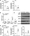 Bmal1 regulates ABCA1 expression by modulating Znf202 expression in human m
