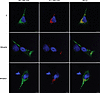 The 8A7 mAb recognizes polymers of AAT variants poorly recognized by the 2C