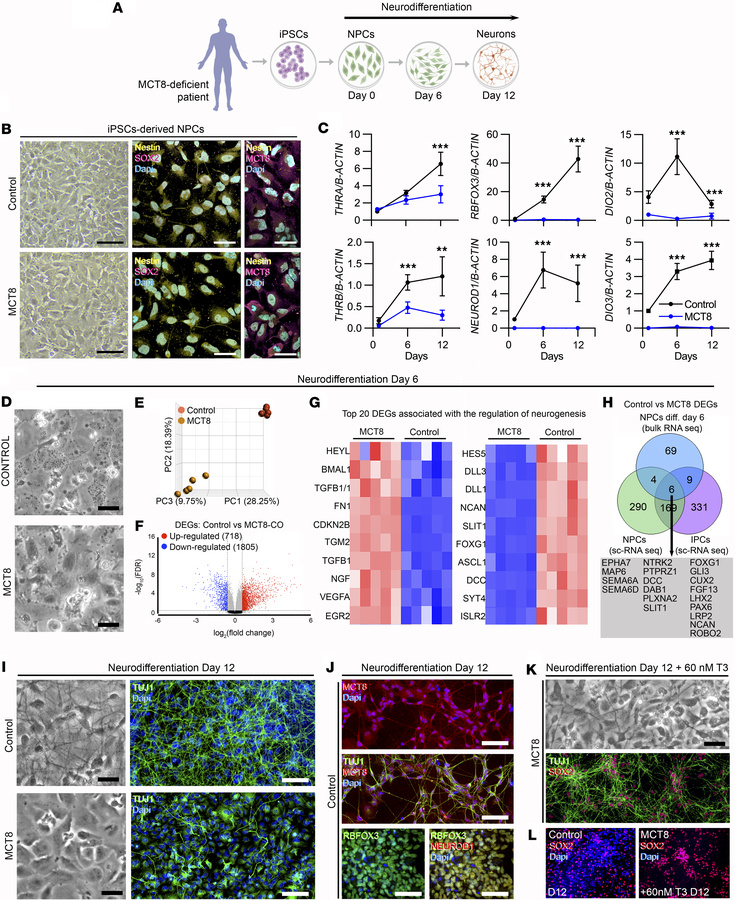 Control- and MCT8-deficient iPSC-derived neurons.
(A) Schematic represen...