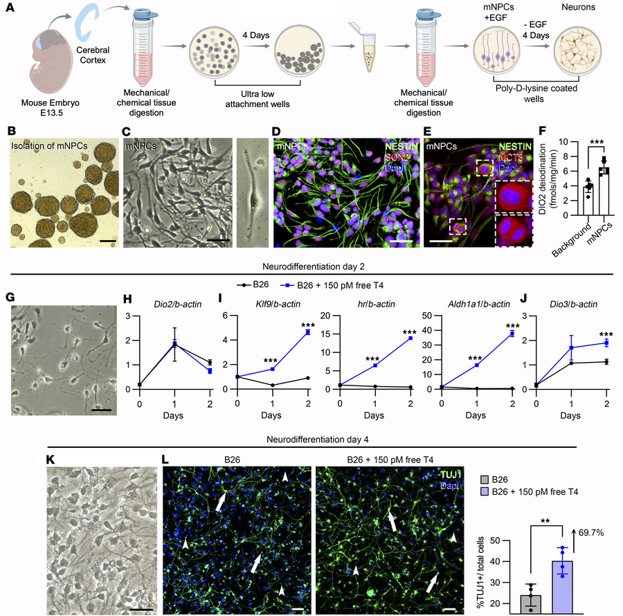 Studies on the presence and effect of the DIO2 pathway in primary mouse ...