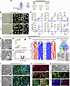 Control- and MCT8-deficient iPSC-derived neurons.