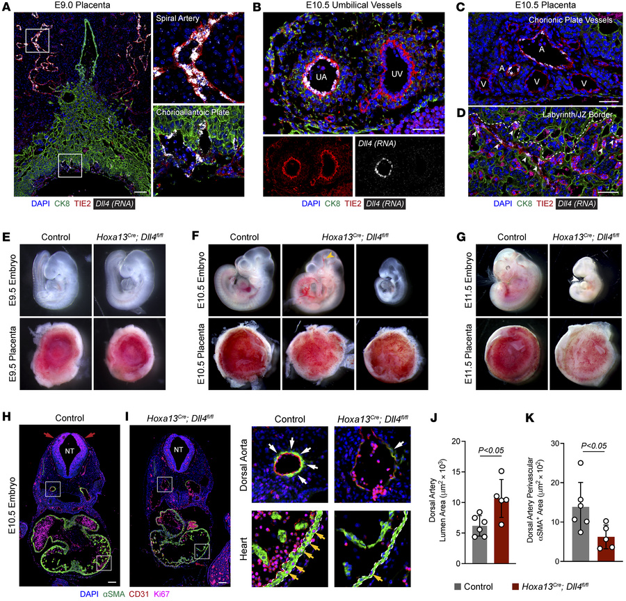 
Dll4 is expressed in umbilical and placental arteries and required for ...