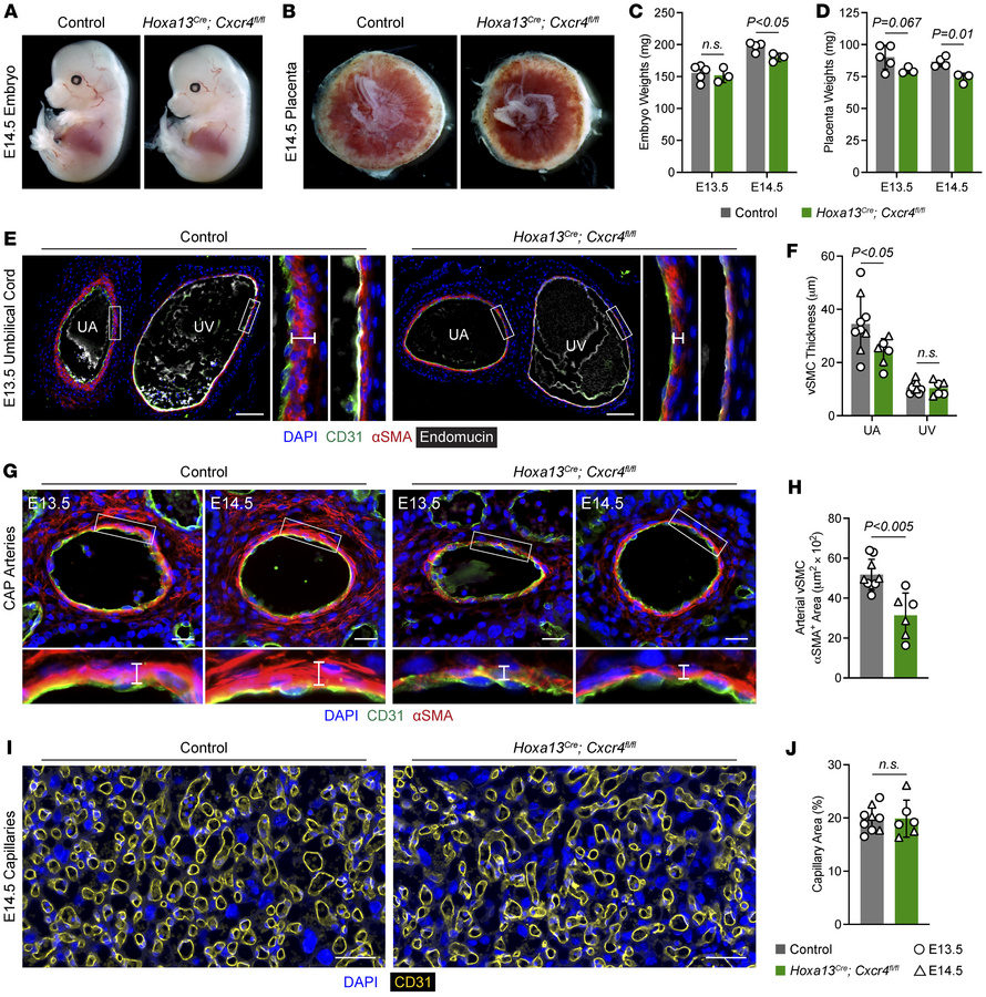 Endothelial Cxcr4 promotes umbilical and placental artery vSMC recruitme...