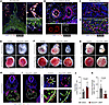 Dll4 is expressed in umbilical and placental arteries and required for embr