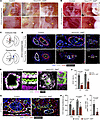Deletion of Dll4 causes umbilical cord atresia and disrupts placental vascu