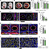 Endothelial Cxcr4 promotes umbilical and placental artery vSMC recruitment.
