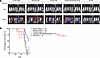 Anti-metastasis activity of TB-VHS against 4T1-HL tumors co-implanted with