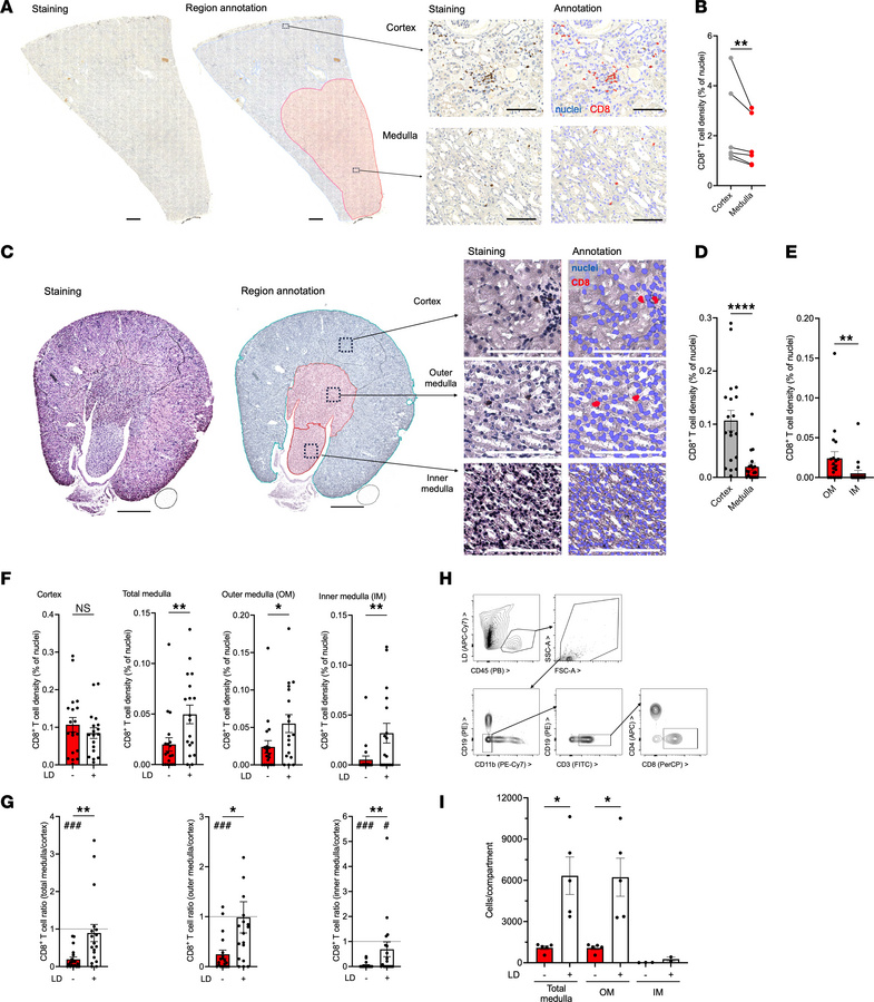 CD8+ T cell distribution in human and murine kidney compartments.
(A and...
