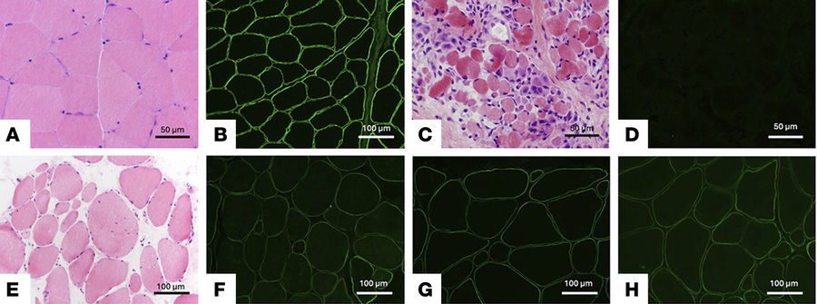 Histopathology and laminin-211 IF of human muscle biopsies.
(A) H&amp;E-...