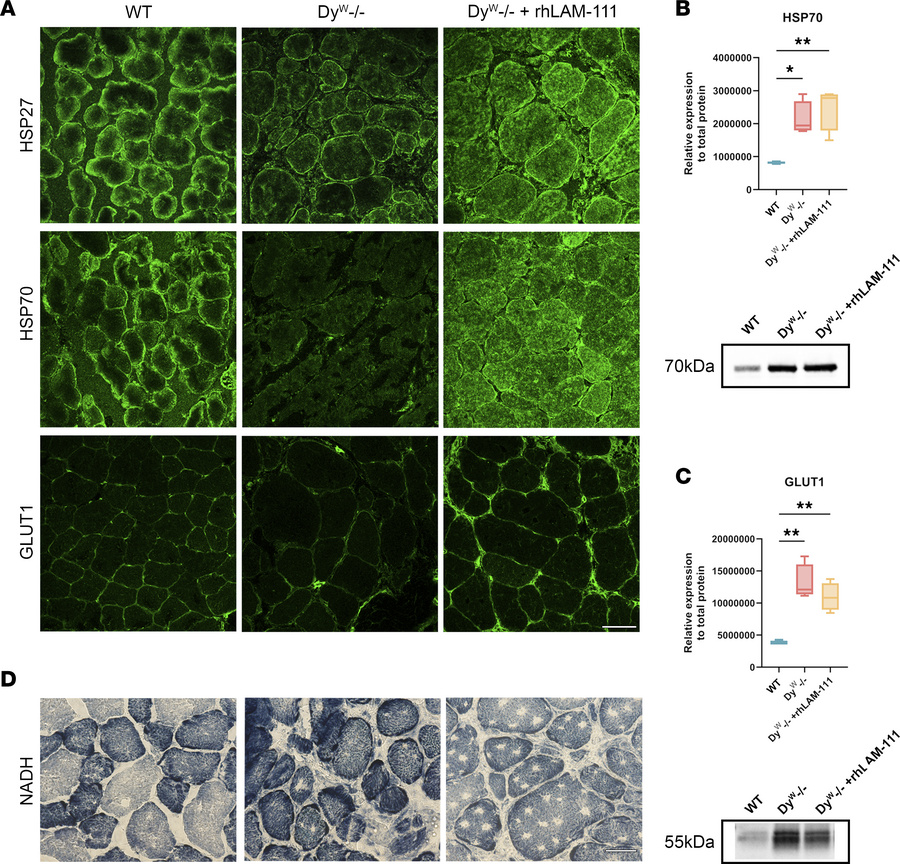 RhLAM-111 treatment increases cytosolic heat shock protein expression an...