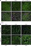 Cytosolic localization of p-JNK in dyW–/– and LAMA2-CMD skeletal muscle.