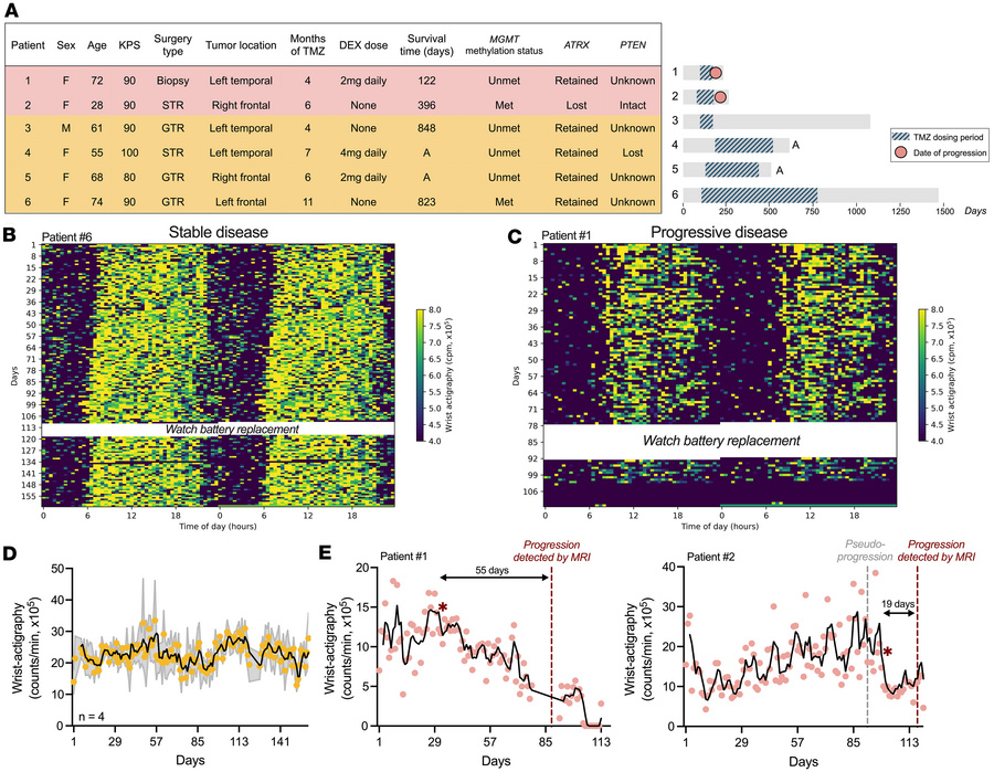 Daily activity declined before clinical detection of GBM progression in ...