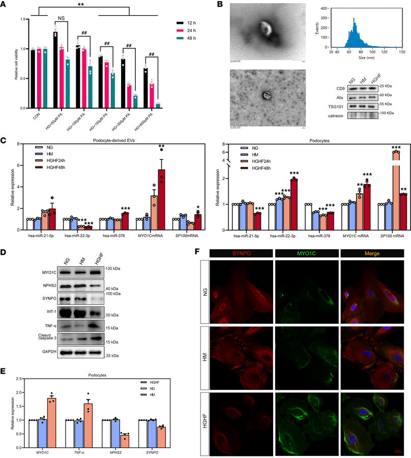 Comprehensive analysis of high glucose and high fat effects on podocyte ...
