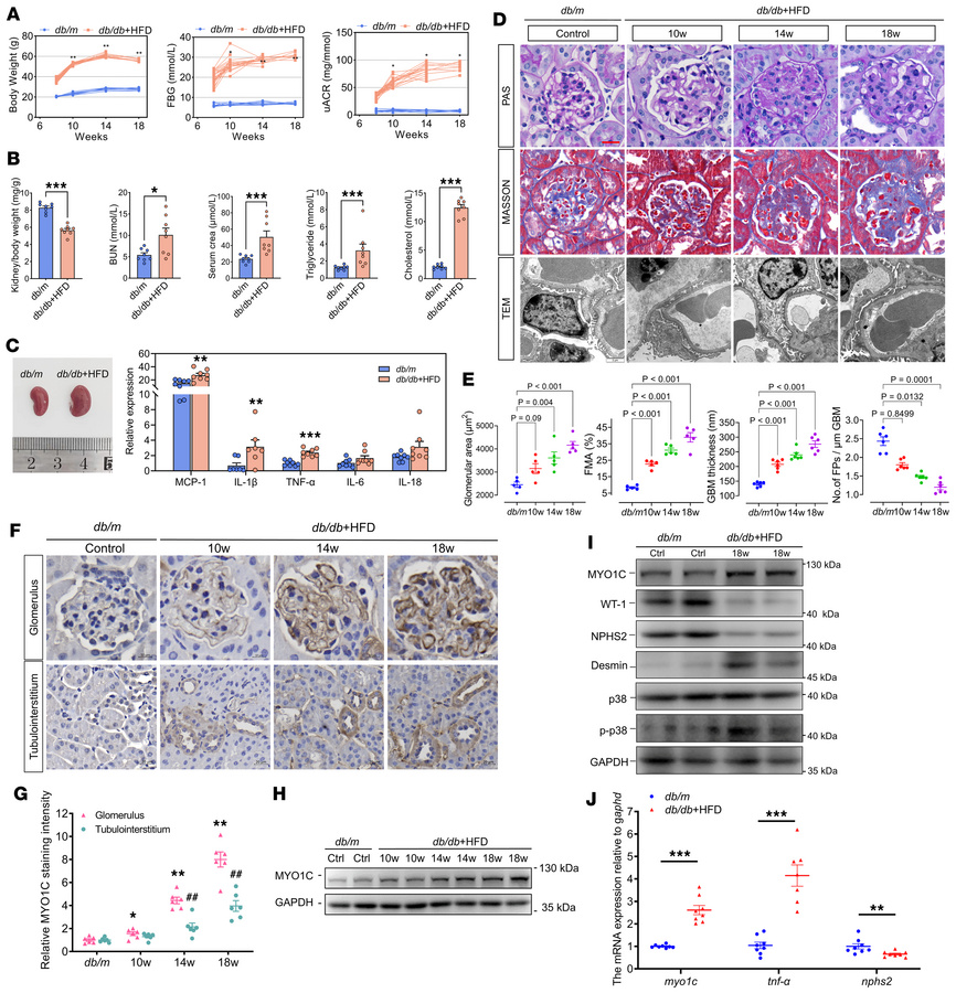 Characterization of renal and systemic changes in db/m and db/db+HFD mou...