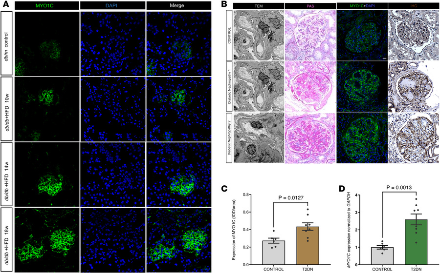 MYO1C expression in mouse and human kidney tissues.
(A) Representative c...