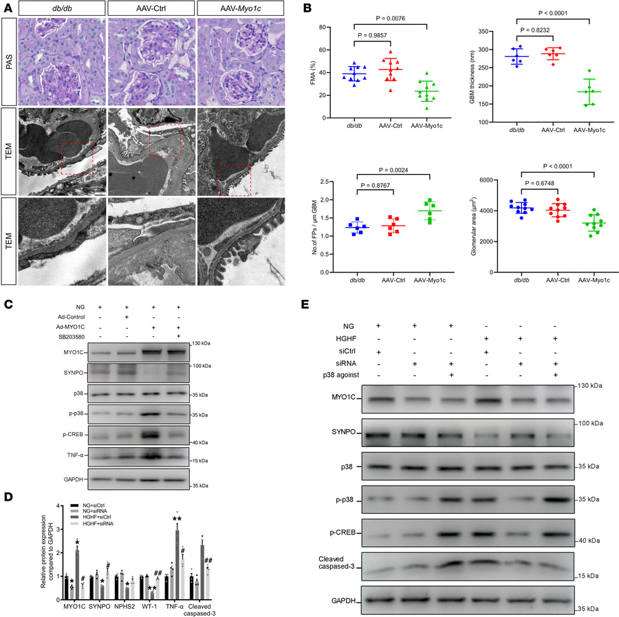 MYO1C mediates HGHF-induced podocyte injury via the p38/p-CREB pathway.
...