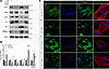 The protective effect of knockdown against HGHF-induced podocyte injury.
