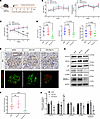 Podocyte-specific knockdown of Myo1c via AAV reduces renal injury in diabet