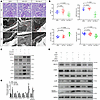 MYO1C mediates HGHF-induced podocyte injury via the p38/p-CREB pathway.