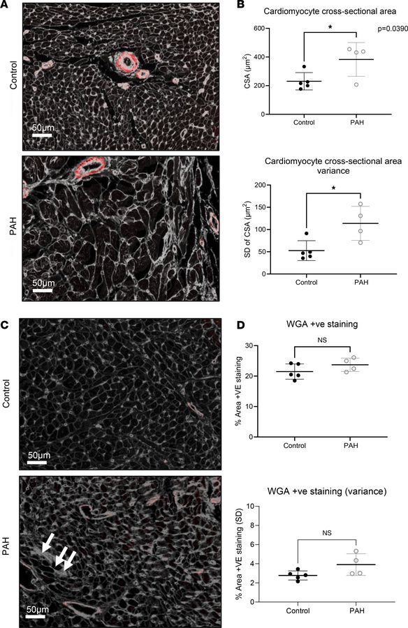 Histological analysis of cardiomyocyte cross-sectional area.
(A) Represe...