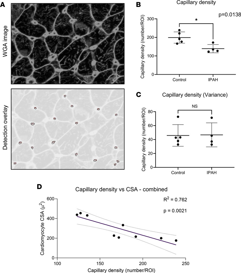 Patients with IPAH display reduced capillary density with a strong corre...